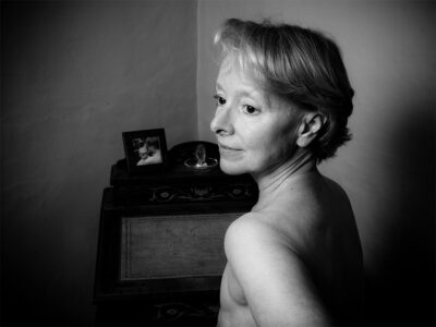 a black and white portrait of Clare, she is turned from the camera, scar tissue is visible were her breasts were